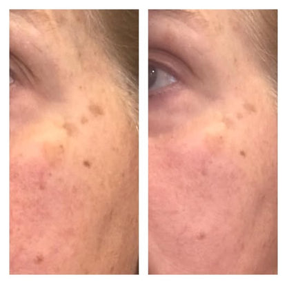 Coffret Transformation Tomate Glow